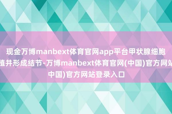 现金万博manbext体育官网app平台甲状腺细胞会很是增殖并形成结节-万博manbext体育官网(中国)官方网站登录入口